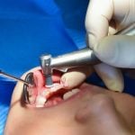 EXPLAINED: How dental care works in Germany